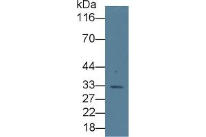 Detection of EPO in Rat Liver lysate using Monoclonal Antibody to Erythropoietin (EPO) (EPO 抗体  (AA 28-193))