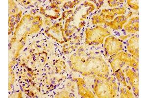 Immunohistochemistry of paraffin-embedded human kidney tissue using ABIN7150914 at dilution of 1:100 (Dysferlin 抗体  (AA 105-278))
