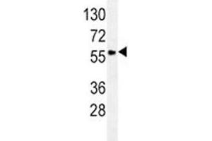 GCET1/SERPINA9 antibody western blot analysis in Ramos lysate. (SERPINA9 抗体  (AA 158-186))