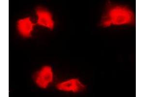 Immunofluorescent analysis of Kanadaptin staining in A431 cells. (NADAP 抗体  (Center))