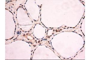 Image no. 8 for anti-Myc Proto-Oncogene protein (MYC) antibody (ABIN1497012) (c-MYC 抗体)