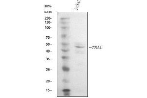Western blot analysis of TCR alpha/TRAC using anti-TCR alpha/TRAC antibody (ABIN6719654). (TRAC 抗体  (AA 1-114))