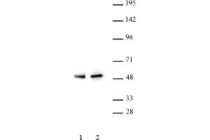 PAX5 antibody (pAb) tested by Western blot. (PAX5 抗体  (N-Term))