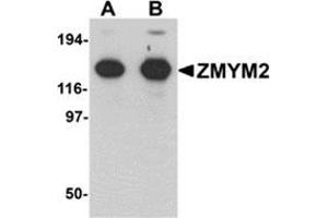 Western blot analysis of ZMYM2 in EL4 cell lysate with ZMYM2 antibody at (A) 0. (ZMYM2 抗体  (N-Term))