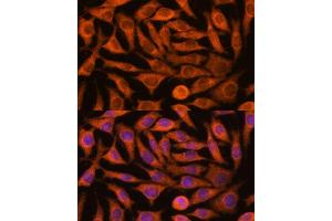 Immunofluorescence (IF) image for anti-NADH Dehydrogenase (Ubiquinone) 1 alpha Subcomplex, Assembly Factor 4 (NDUFAF4) (AA 1-170) antibody (ABIN7268807)