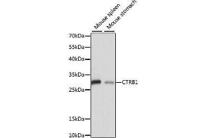 Western blot analysis of extracts of various cell lines, using CTRB1 antibody (ABIN7266398) at 1:1000 dilution. (CTRB1 抗体  (AA 79-263))