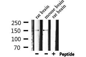 Western blot analysis of extracts from rat brain, mouse brain, using Phospho-PLCG1 (Tyr771) Antibody. (Phospholipase C gamma 1 抗体  (pTyr771))