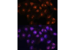 Immunofluorescence analysis of HeLa cells using Fibrillarin/U3 RNP antibody (ABIN6130429, ABIN6140494, ABIN6140496 and ABIN6217509) at dilution of 1:100. (Fibrillarin 抗体  (AA 100-321))