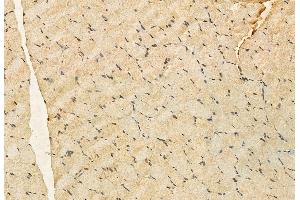 ABIN6259701 and ABIN6272909 at 1/100 staining Rat muscle tissue by IHC-P.
