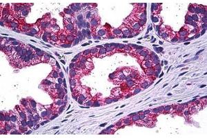 Human Prostate: Formalin-Fixed, Paraffin-Embedded (FFPE) (MAPK13 抗体  (AA 251-365))