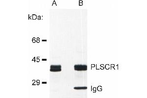 Detection of PLSCR1 in rat basophilic leukemia (RBL) cell line lysate (A) and in PLSCR1 immunoprecipitate from RBL lysate (B). (PLSCR1 抗体)