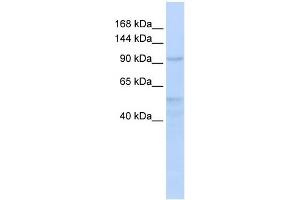 WB Suggested Anti-INTS4 Antibody Titration:  0. (INTS4 抗体  (Middle Region))