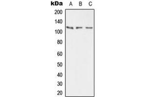 Western blot analysis of PMCA2 expression in HEK293T (A), mouse brain (B), rat brain (C) whole cell lysates. (ATP2B2 抗体  (Center))