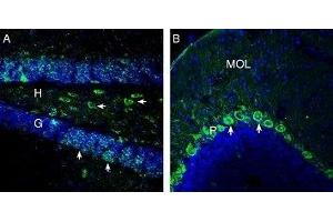 Expression of OXGR1/GPR99 in mouse hippocampus and cerebellum - Immunohistochemical staining of perfusion-fixed frozen mouse brain sections with Anti-OXGR1/GPR99 Antibody (ABIN7043418, ABIN7044895 and ABIN7044896), (1: 200), followed by goat anti-rabbit-AlexaFluor-488. (OXGR1 抗体  (Intracellular))