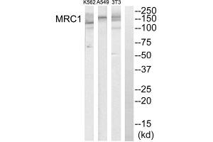 Western blot analysis of extracts from K562 cells, A549 cells and NIH-3T3 cells, using MRC1 antibody. (Macrophage Mannose Receptor 1 抗体  (Internal Region))