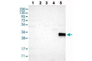 Western blot analysis of Lane 1: RT-4 cells, Lane 2: U-251MG sp cells, Lane 3: Human plasma (IgG/HSA depleted), Lane 4: Human liver tissue, Lane 5: Human tonsil tissue with CD226 polyclonal antibody . (CD226 抗体  (AA 102-251))