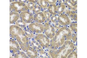 Immunohistochemistry of paraffin-embedded Mouse kidney using NLRC4 Polyclonal Antibody at dilution of 1:100 (40x lens). (NLRC4 抗体)
