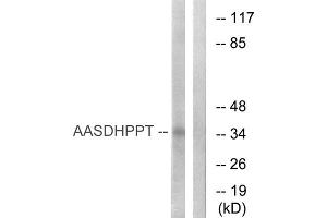 Western blot analysis of extracts from COLO cells, using AASDHPPT antibody. (AASDHPPT 抗体  (N-Term))