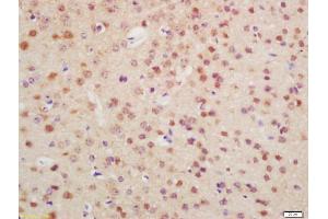 Formalin-fixed and paraffin embedded mouse brain labeled with Anti-OTX1 + OTX2 Polyclonal Antibody, Unconjugated (ABIN1387702) at 1:200 followed by conjugation to the secondary antibody and DAB staining (Otx1 + Otx2 (AA 21-120) 抗体)
