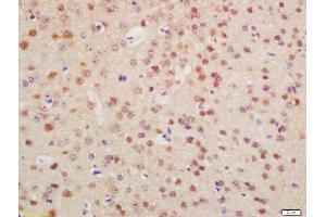 Formalin-fixed and paraffin embedded mouse brain labeled with Anti-OTX1 + OTX2 Polyclonal Antibody, Unconjugated (ABIN1387702) at 1:200 followed by conjugation to the secondary antibody and DAB staining (Otx1 + Otx2 (AA 21-120) 抗体)