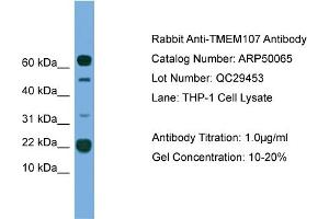 WB Suggested Anti-TMEM107  Antibody Titration: 0. (TMEM107 抗体  (N-Term))