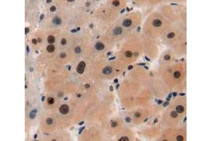 Used in DAB staining on fromalin fixed paraffin-embedded liver tissue (TPI1 抗体  (AA 1-286))