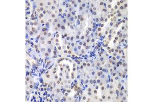 Immunohistochemistry of paraffin-embedded mouse kidney using PRKCB antibody at dilution of 1:200 (400x lens). (PKC beta 抗体)
