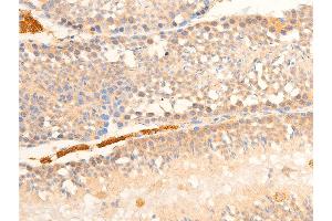ABIN6267070 at 1/100 staining mouse testis tissue sections by IHC-P. (NF-kB p65 抗体  (pSer536))