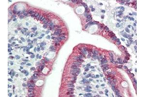 Human Small Intestine (formalin-fixed, paraffin-embedded) stained with LASS5at 5 µg/ml followed by biotinylated goat anti-rabbit IgG secondary antibody, alkaline phosphatase-streptavidin and chromogen. (LASS5 抗体  (C-Term))