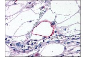 Human Adipocytes: Formalin-Fixed, Paraffin-Embedded (FFPE) (TRIM7 抗体  (C-Term))