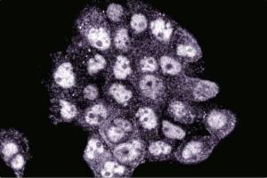 Immunofluorescence staining of A431 cells (Human epithelial carcinoma, ATCC CRL-1555).