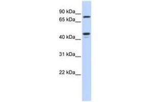 Image no. 1 for anti-Carbohydrate (N-Acetylglucosamine 6-O) Sulfotransferase 6 (CHST6) (AA 288-337) antibody (ABIN6743497) (CHST6 抗体  (AA 288-337))