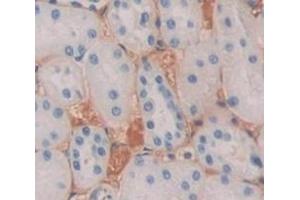 Immunohistochemistry (IHC) image for anti-Sema Domain, Immunoglobulin Domain (Ig), Transmembrane Domain (TM) and Short Cytoplasmic Domain, (Semaphorin) 4D (SEMA4D) (AA 145-494) antibody (ABIN7443494)