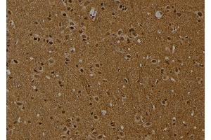 ABIN6274016 at 1/100 staining Rat brain tissue by IHC-P. (Histone H2A 抗体  (acLys9))