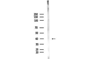 Western blot analysis of lysates from Rat brain, using Phospho-AurB (Thr232) Antibody at 1/1000 dilution.