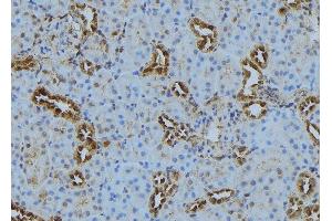 ABIN6272878 at 1/100 staining Mouse kidney tissue by IHC-P. (PLOD3 抗体  (C-Term))