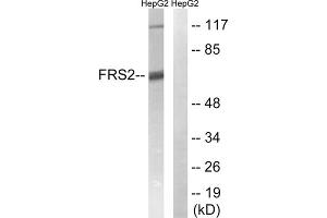 Western blot analysis of extracts from HepG2 cells, using FRS2 (epitope around residue 196) antibody. (FRS2 抗体  (Tyr196))