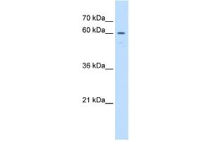 WB Suggested Anti-UNCX Antibody Titration:  1 ug/ml  Positive Control:  Jurkat cell lysate (UNCX 抗体  (C-Term))