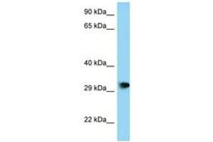 Image no. 1 for anti-PHD Finger Protein 23 (PHF23) (AA 191-240) antibody (ABIN6748146) (PHF23 抗体  (AA 191-240))