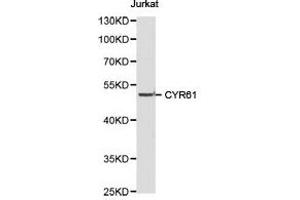 Western Blotting (WB) image for anti-Cysteine-Rich, Angiogenic Inducer, 61 (CYR61) antibody (ABIN1872182) (CYR61 抗体)