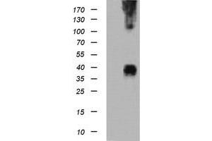 Image no. 1 for anti-Mitogen-Activated Protein Kinase Kinase 3 (MAP2K3) antibody (ABIN1499412) (MAP2K3 抗体)