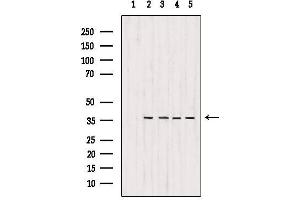 Western blot analysis of extracts from various samples, using MDH1 Antibody. (MDH1 抗体  (C-Term))