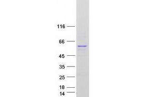 Western Blotting (WB) image for Thyroid Hormone Receptor, beta (THRB) (Transcript Variant 2) protein (Myc-DYKDDDDK Tag) (ABIN2733597)