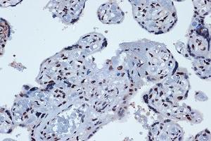 Immunohistochemistry of paraffin-embedded human placenta using PROX1 Rabbit mAb (ABIN7269571) at dilution of 1:100 (40x lens). (PROX1 抗体)