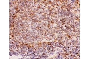 Immunohistochemistry (IHC) image for anti-Integrin beta 2 (ITGB2) (AA 17-382) antibody (ABIN3031376)