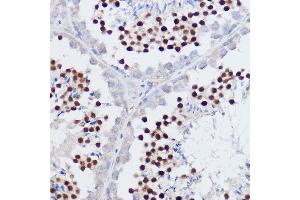 Immunohistochemistry of paraffin-embedded mouse testis using PPARD Rabbit pAb (ABIN6132423, ABIN6146002, ABIN6146003 and ABIN6221300) at dilution of 1:50 (40x lens). (PPARD 抗体  (AA 102-361))