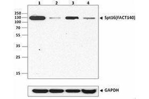 Western Blotting (WB) image for anti-FACT complex subunit SPT16 (SUPT16H) antibody (ABIN2666085) (SUPT16H 抗体)