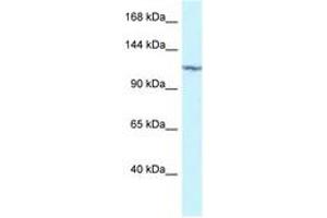 Image no. 1 for anti-Protein Kinase N2 (PKN2) (AA 605-654) antibody (ABIN6747330) (PKN2 抗体  (AA 605-654))