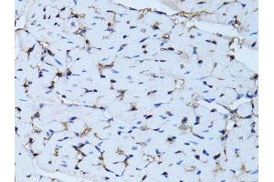 Immunohistochemistry of paraffin-embedded mouse heart using FABP4 antibody (ABIN5970061) at dilution of 1/100 (40x lens).