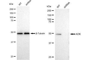 Western blotting analysis using ADK antibody (ABIN7797517). (Recombinant ADK 抗体)